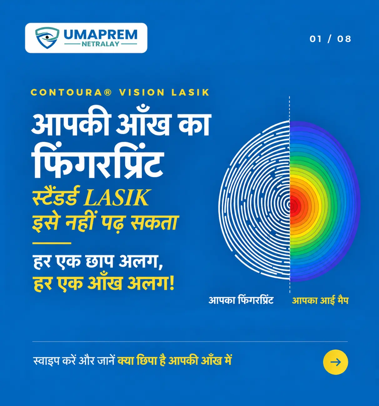 एक जैसा चश्मे का नंबर, फिर भी हर आँख अलग क्यों? जानिए Contoura Vision LASIK
