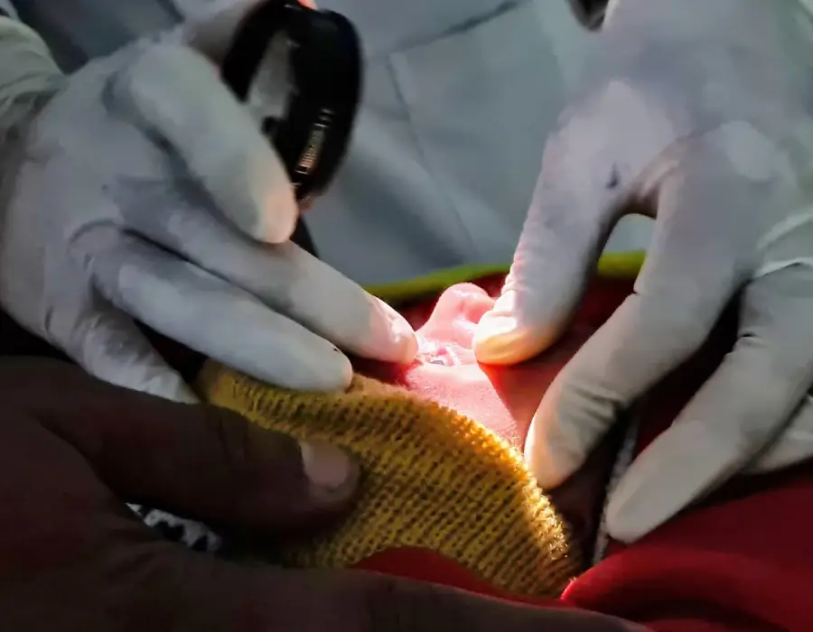 ROP Screening and Treatment